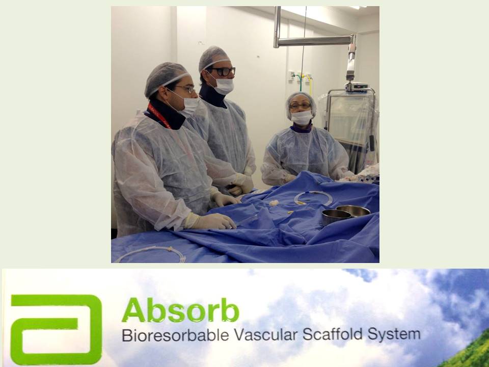 Em 2015 a CINECORS foi pioneira e implantou o primeiro stent bioabsorvível de Porto Alegre.